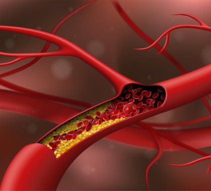 Cholesterol